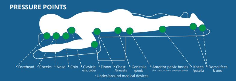 Prone Position: Definition, Benefits, and Process Explained