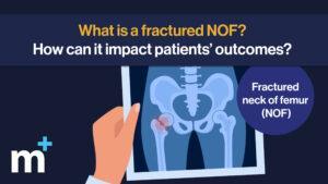 What is a fractured neck of femur (NOF)?